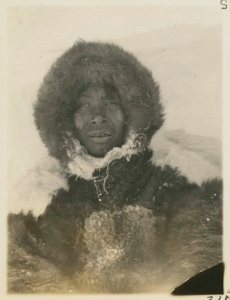 Image: Eskimo [Inughuit] with frozen cheek